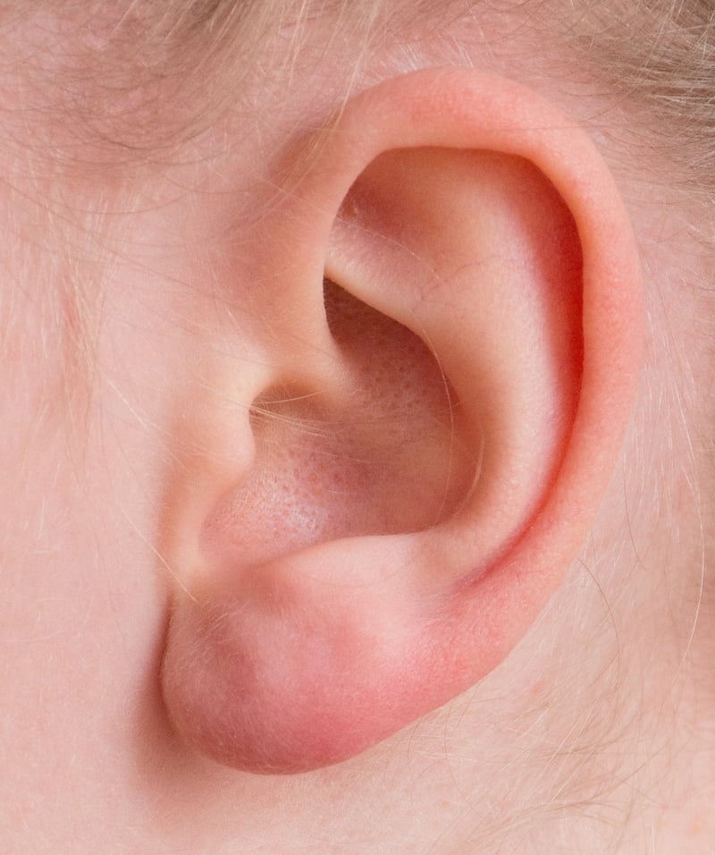 Listening Ear